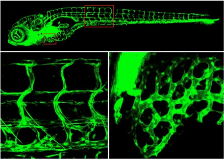 Mechanical and Genetic Aspects of Cardiovascular Diseases (Professor Chih-Wen Ni)